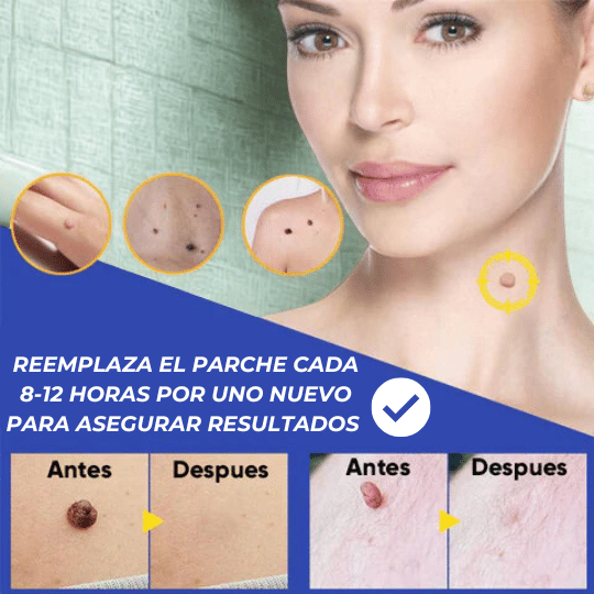 Formuclear™144 – Parches para eliminar verrugas