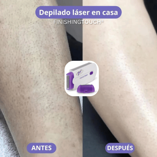 Venus™- Depilación Laser rápida e indolora