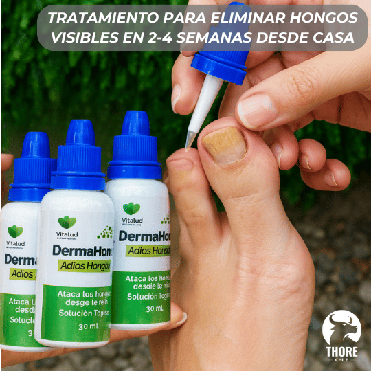 COMBO 3X1 Tratamiento Anti Hongos 14 Días