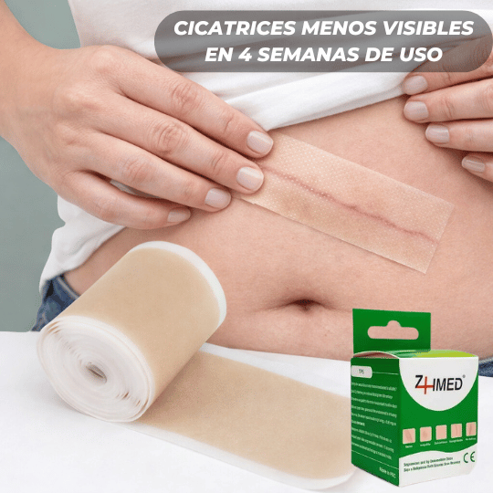 Rollo de Silicona ScarPro™ – Atenúa cicatrices y marcas visibles