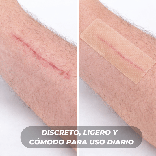 Rollo de Silicona ScarPro™ – Atenúa cicatrices y marcas visibles