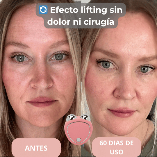 Masajeador Renévion™ para reafirmar tu piel